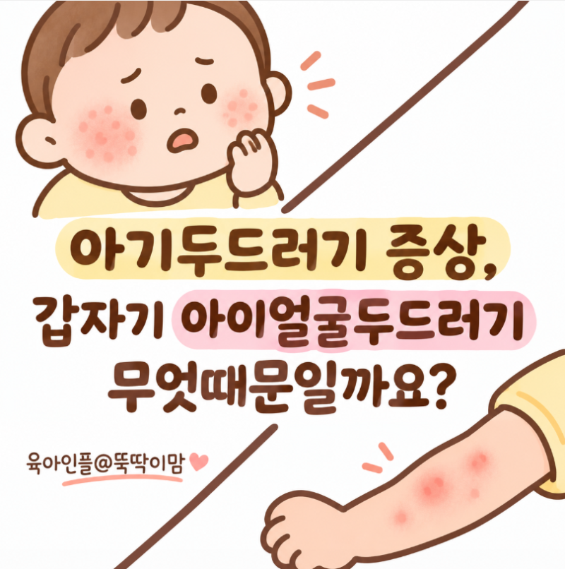 아기두드러기 증상, 갑자기 아이얼굴두드러기 무엇때문일까요?