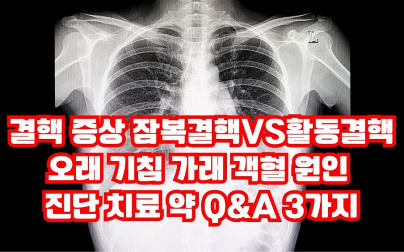 결핵 증상 오래 기침 가래 감염 원인 진단 치료 약 잠복결핵 활동성 결핵 차이 Q&A 3가지