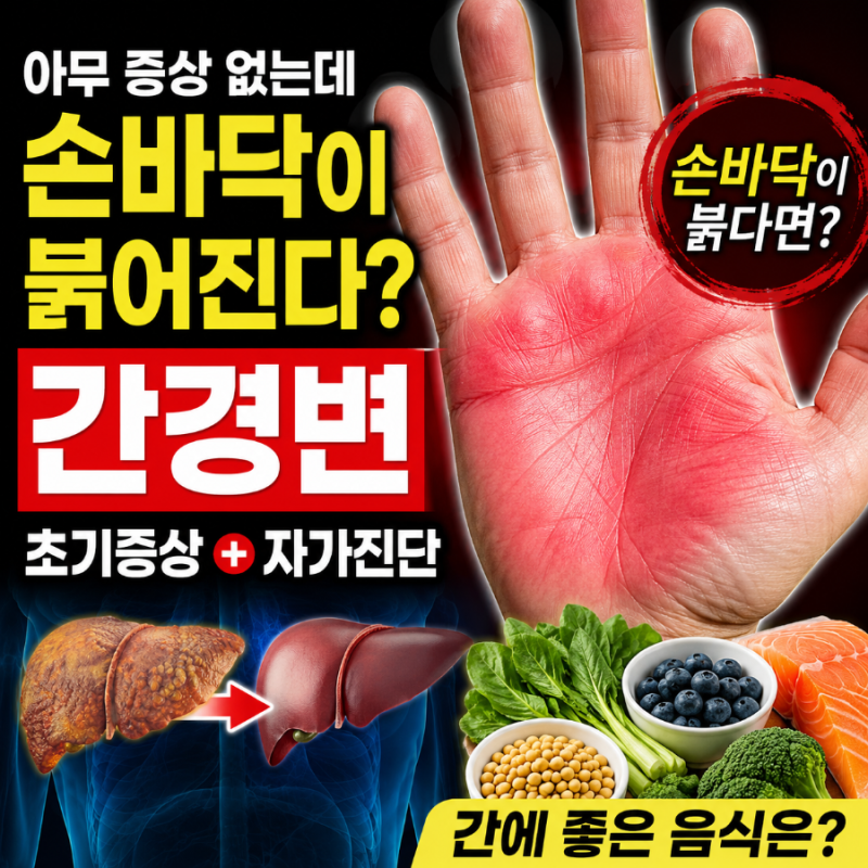 간경변 초기증상 (+자가진단, 좋은음식) - 아무 증상 없다가 손바닥이 붉어지면 의심해야 하....