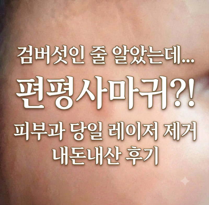 검버섯인 줄 알았는데 편평사마귀? 피부과 당일 레이저 제거 내돈내산 후기 (비용, 통증, 관....