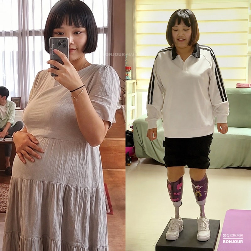 인간극장 김나현, 임신 8개월에 둘째 잃고 두 다리까지 절단... 무슨 일이 있었나