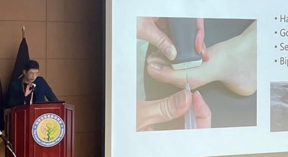 새끼발가락물집 원인? 통증이 반복된다면 (소건막류/의사 설명)