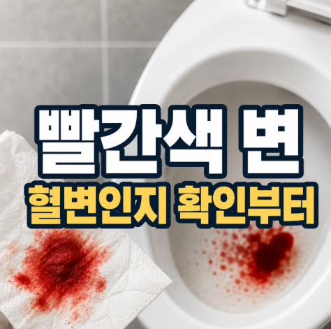 “변이 빨갛게 보여 혈변이 걱정된다면…” 먼저 살펴볼 원인과 진료 시점
