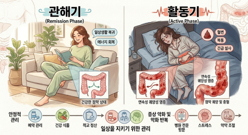 궤양성대장염 진단 후 6년｜나는 지금 어떻게 지내고 있을까?(나의후기)