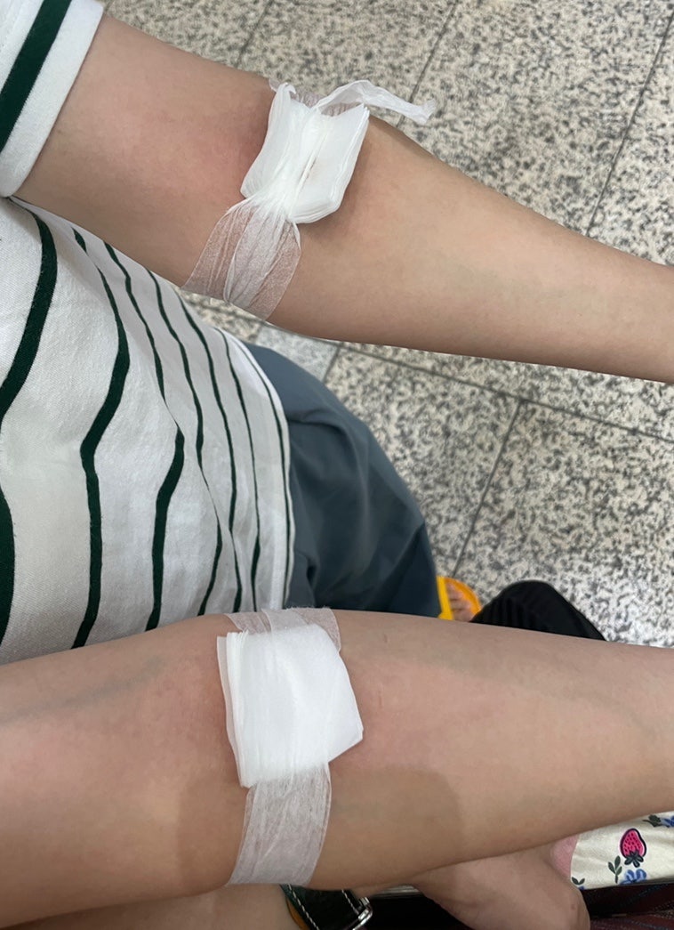[자궁근종] 분당서울대병원 산부인과 자궁근종수술 전 검사