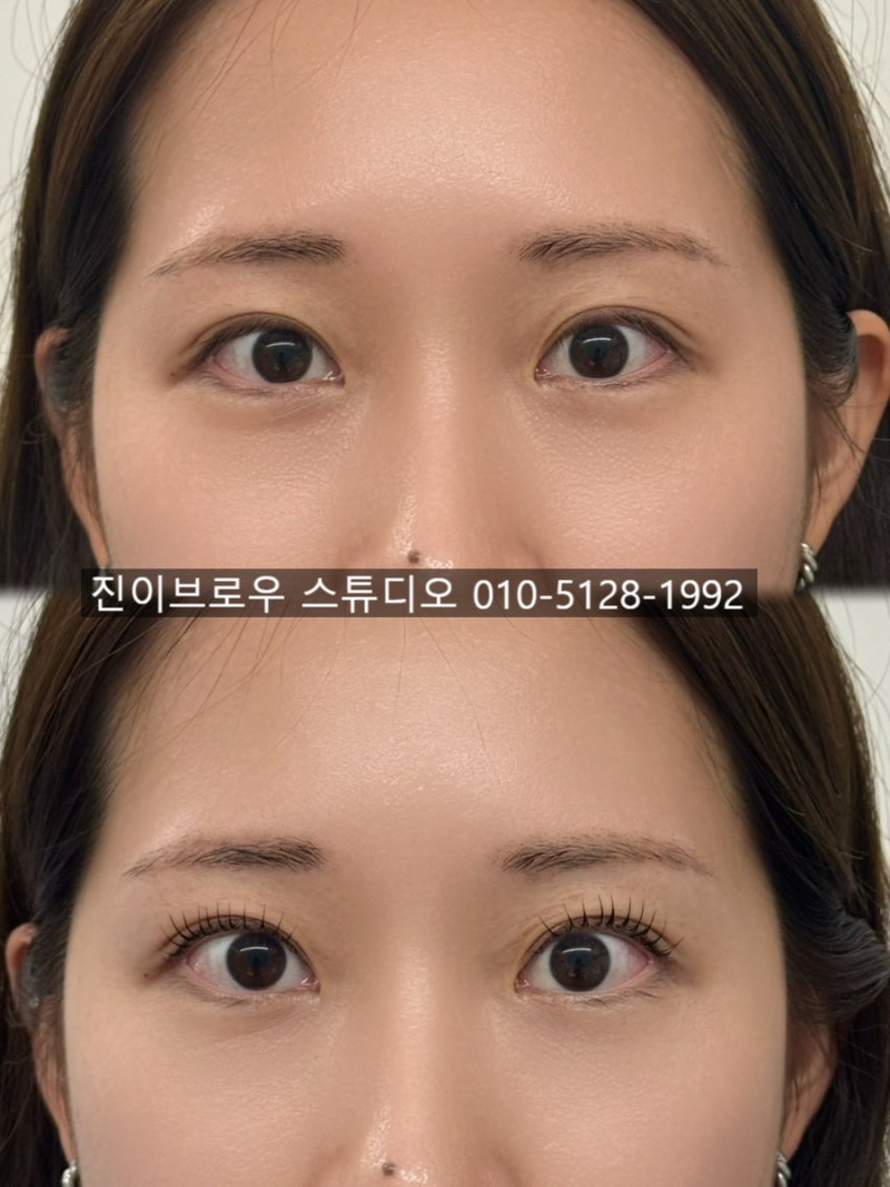 의정부역 블랙틴팅펌 시술 전후 차이점과 후기 많은 곳(+비용)