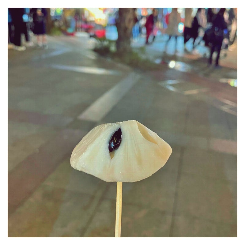 산부인과 산전검사 비용 절약한 내 경험담
