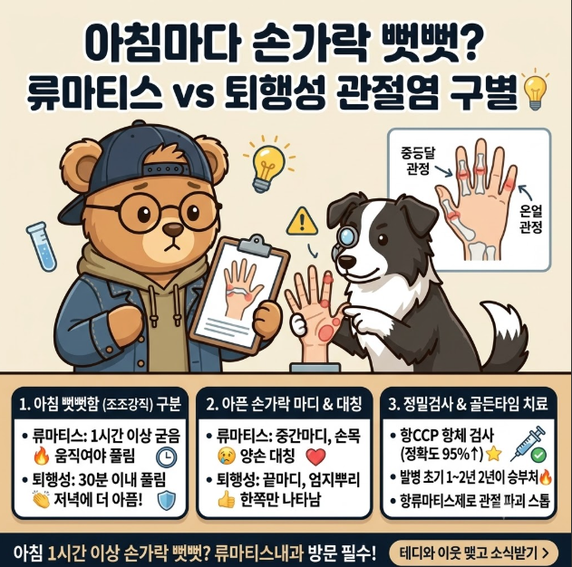 [손가락 관절 통증] 아침마다 손가락이 뻣뻣? 류마티스 vs 퇴행성 관절염 구별법