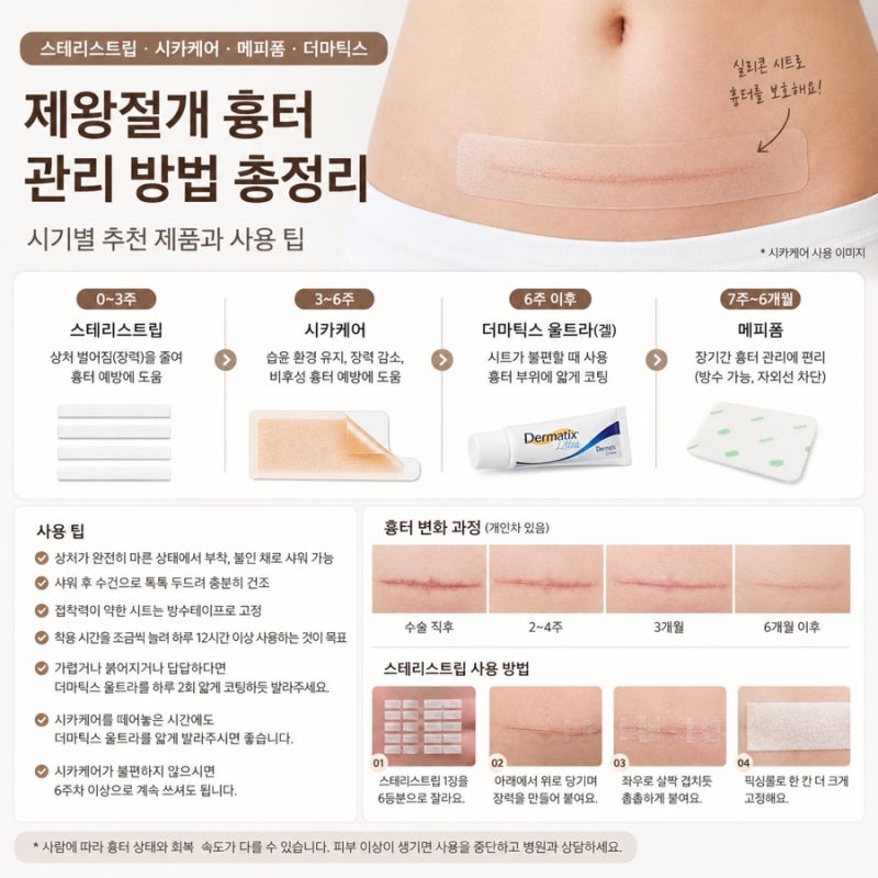 출산을 앞두고 미리 알아본 제왕절개 흉터 관리 - 스테리스트립·시카케어·메피폼