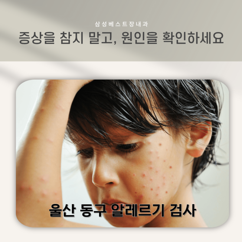[울산 동구 알러지] 알레르기-두드러기 검사 (급성 MAST, 음식물 지연성, 실비보험적용, 비용, ....