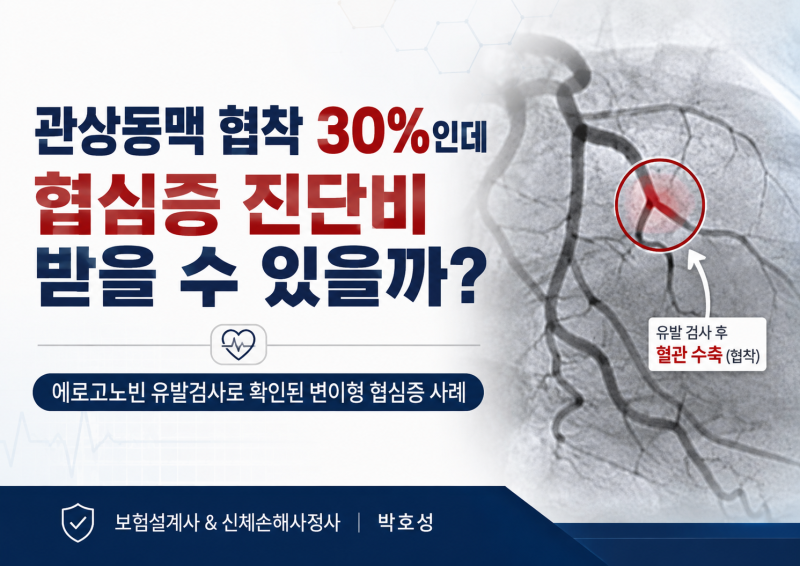 관상동맥 협착 30%인데 협심증 진단비 받을 수 있을까?｜변이형 협심증 보험금 6,600만원 지급 ....