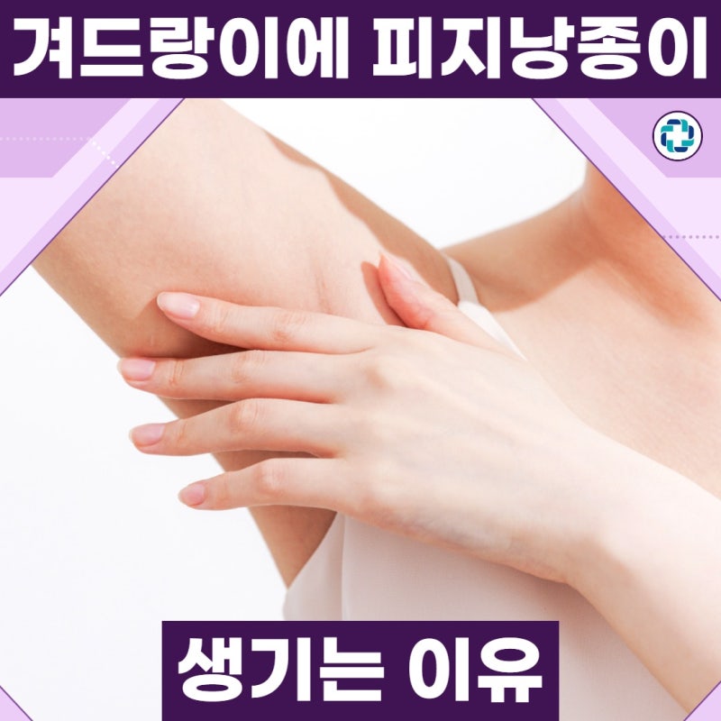겨드랑이 피지낭종 원인과 증상, 전기소작술은 언제 고려할까?