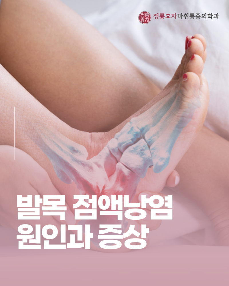 발목 점액낭염, 발목이 붓고 눌렀을 때 아프다면