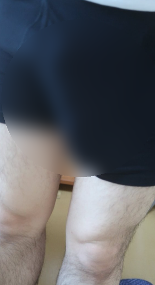 팔팔정 처방 가격 무작정 검색하지 마세요! (전직 실장의 솔직한 조언)