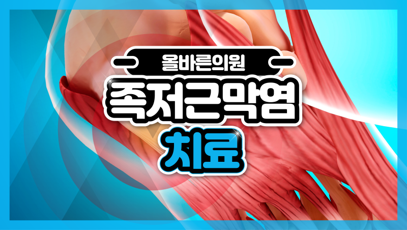 방배동 족저근막염 체외충격파 치료 필요한 상황은?