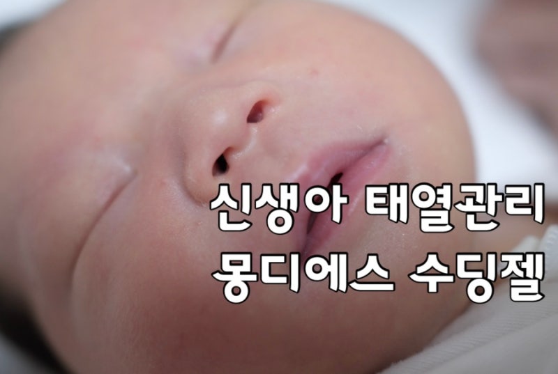 [신생아 태열 관리]몽디에스 수딩젤로 아기 얼굴 붉은기 잡는 꿀팁