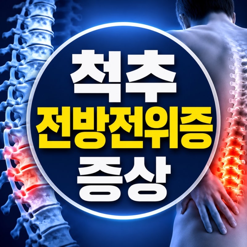 척추전방전위증 증상, 허리보다 다리가 먼저 보내는 신호