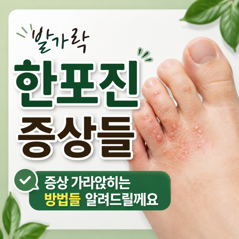 발가락 한포진 증상들과 증상 가라앉히는 방법들 알려드릴게요