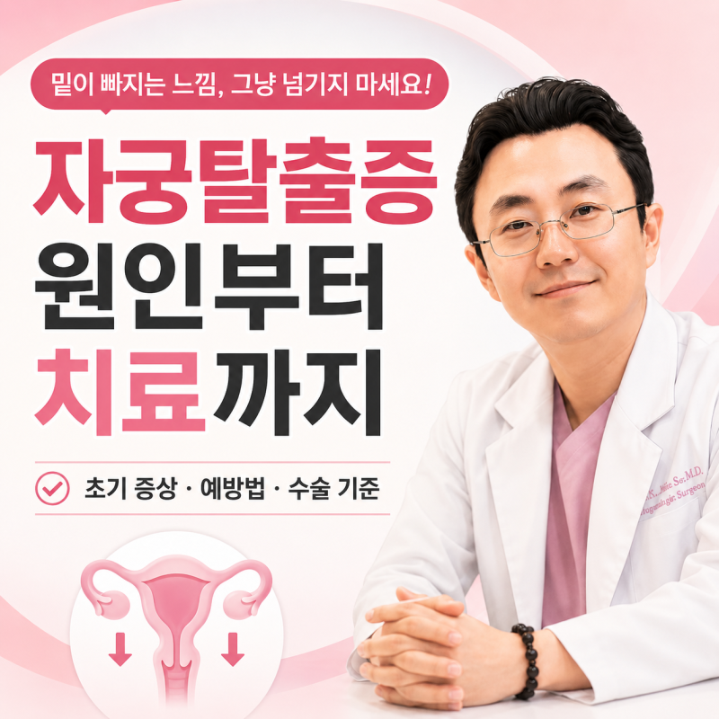 자궁탈출증 증상부터 수술까지, 환자가 꼭 알아야 할 기준