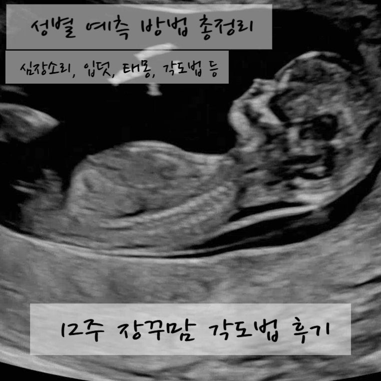 임신 12주차 성별 예측해보기｜심장소리, 태몽, 입덧, 장꾸맘 각도법후기