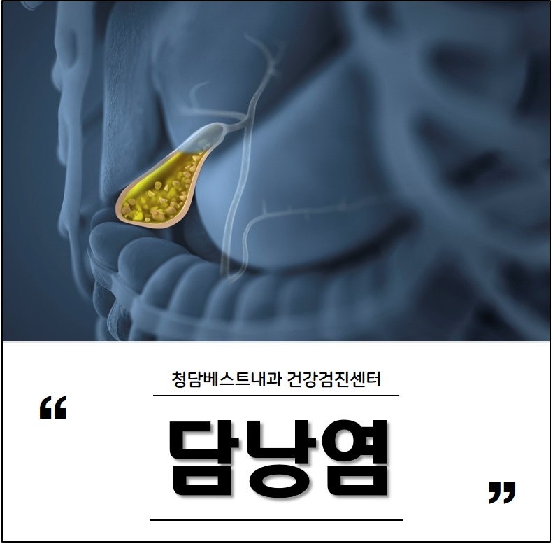 급성 / 만성 담낭염 증상은? 주요 원인은 담석!