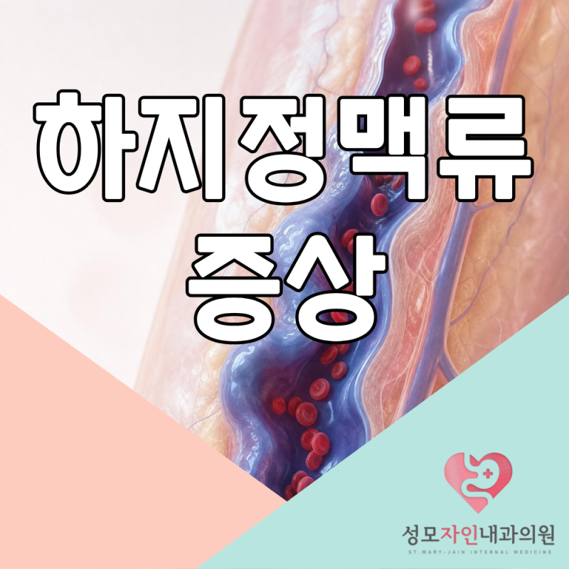 하지정맥류, 제주 내과 진료가 필요할까? 다리 붓고 무거운 이유 총정리