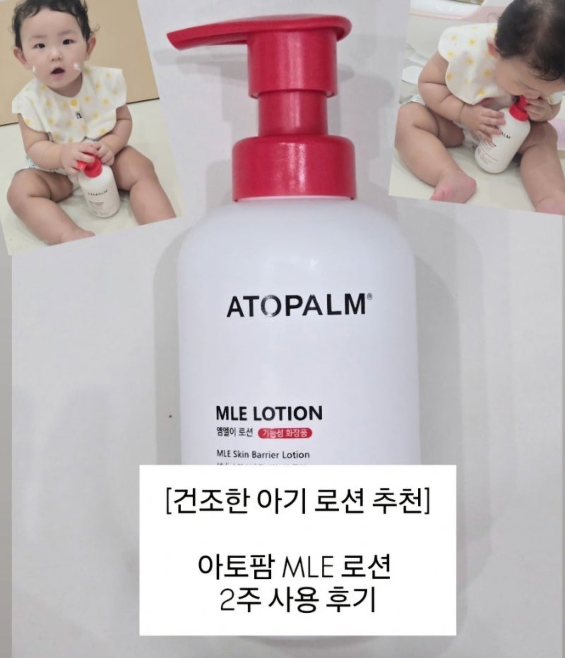아기 로션 추천｜예민하고 건조한 둘째 아토팜 MLE 로션 2주 사용후기
