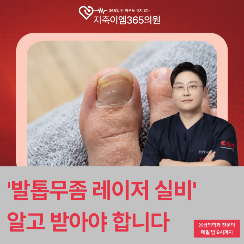 발톱무좀 레이저 실비, 지원되는 경우와 조심할 점 3가지 총정리