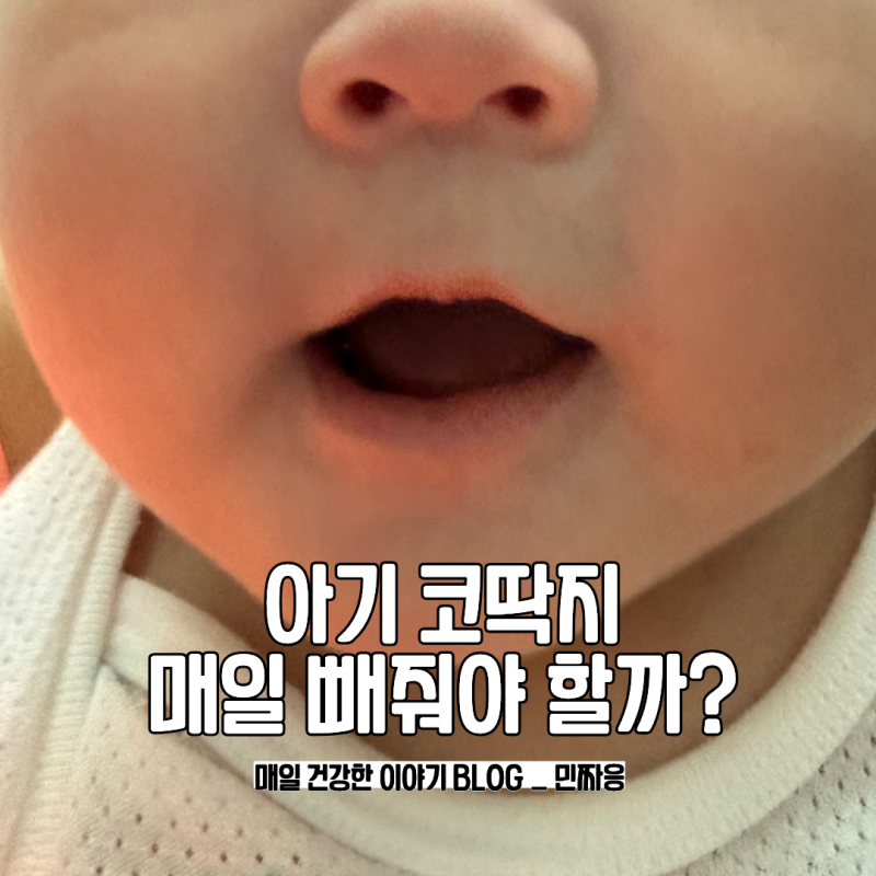 아기 코딱지 매일 빼줘야 할까 코막힘 관리 방법