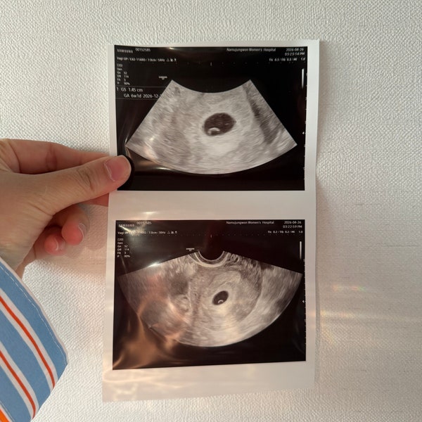 [임신기록] BABY #3 임신 4~6주차｜첫 산부인과 방문, 아기집·난황 확인(임신 초기 해외여행 + ....