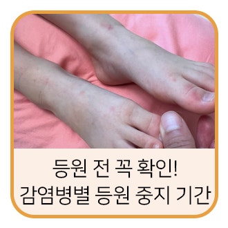 우리 둘째 수족구 확진 받고 알아본 감염병 등원 기준 총정리 (감기부터 노로바이러스까지)
