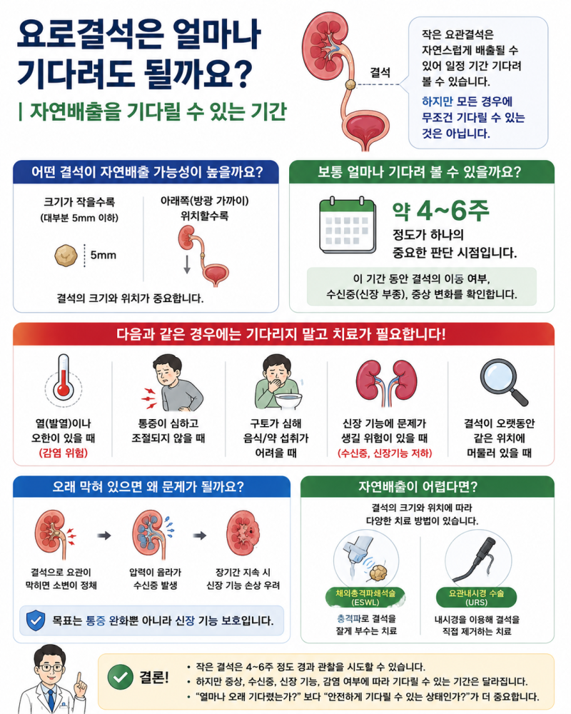 요로결석은 얼마나 기다려도 될까요?｜자연배출을 기다릴 수 있는 기간