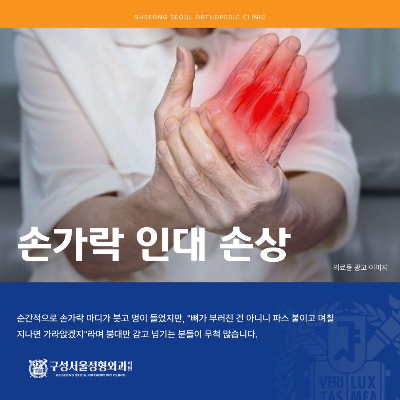 손가락 인대 손상, 제때 대처하지 않으면 안 되는 이유