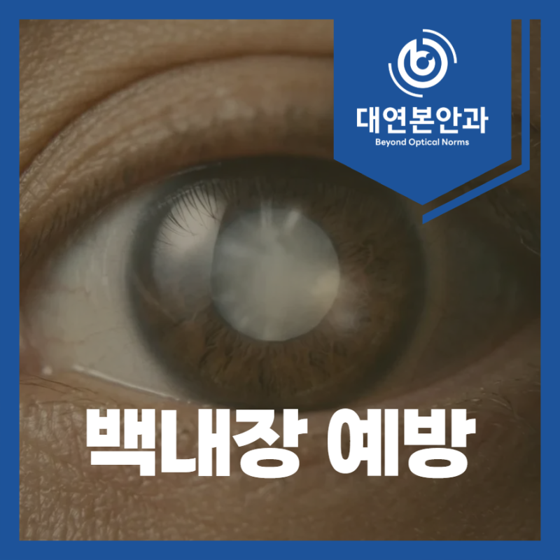 부산남구안과 눈 영양제, 안약으로 백내장을 예방할 수 있다? 확인!