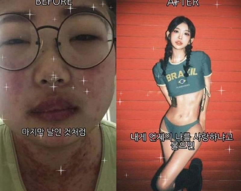 뼈말라 41kg 최준희, "성형 전 살부터 빼라"던 이유…충격 그 자체였다