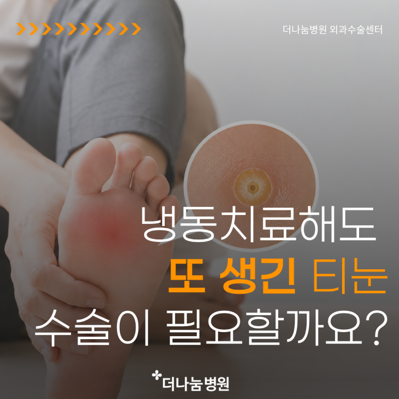 인천 인하대역 티눈수술병원, 냉동치료 여러번 했는데 또 생긴 티눈 외과적 수술이 필요한 ....
