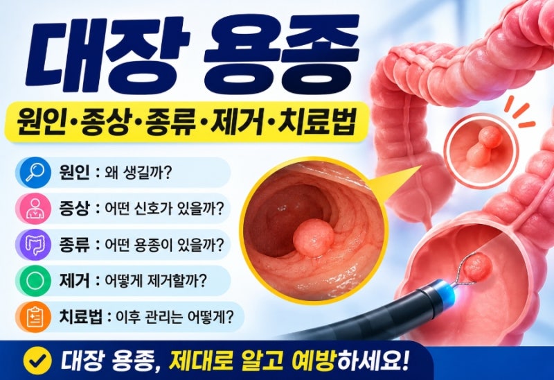 대장 용종 원인·증상·종류·제거·치료법 총정리｜대장내시경에서 용종이 발견됐다면?