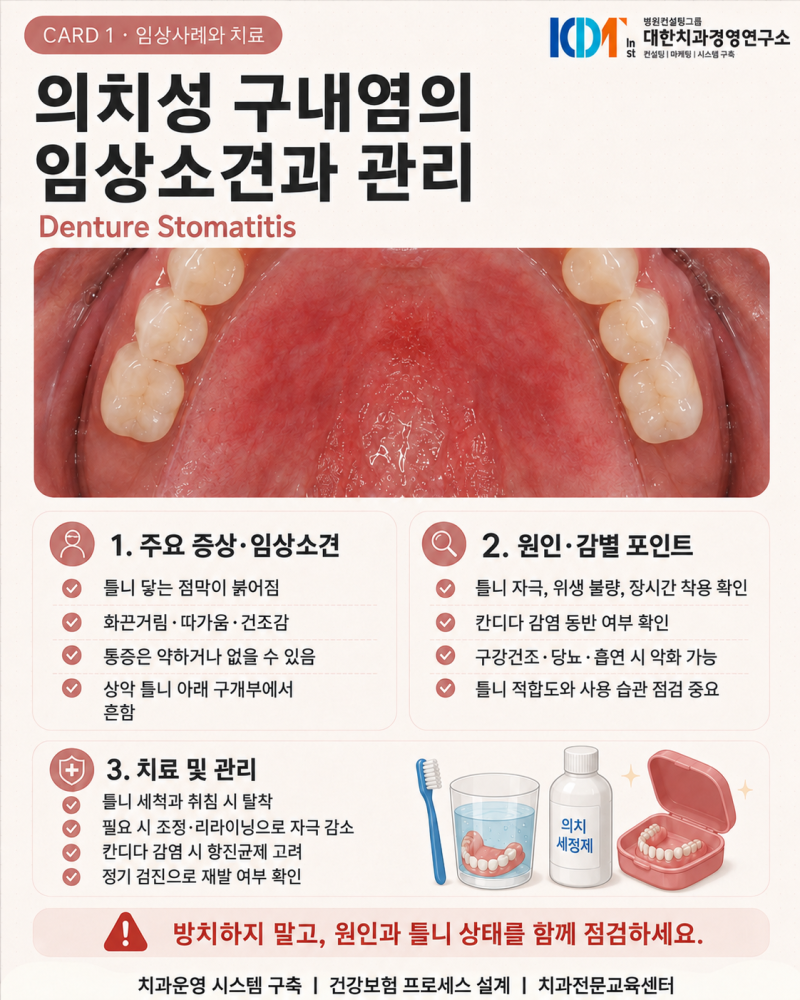의치성 구내염, 틀니 때문에 잇몸이 붉고 따갑다면?