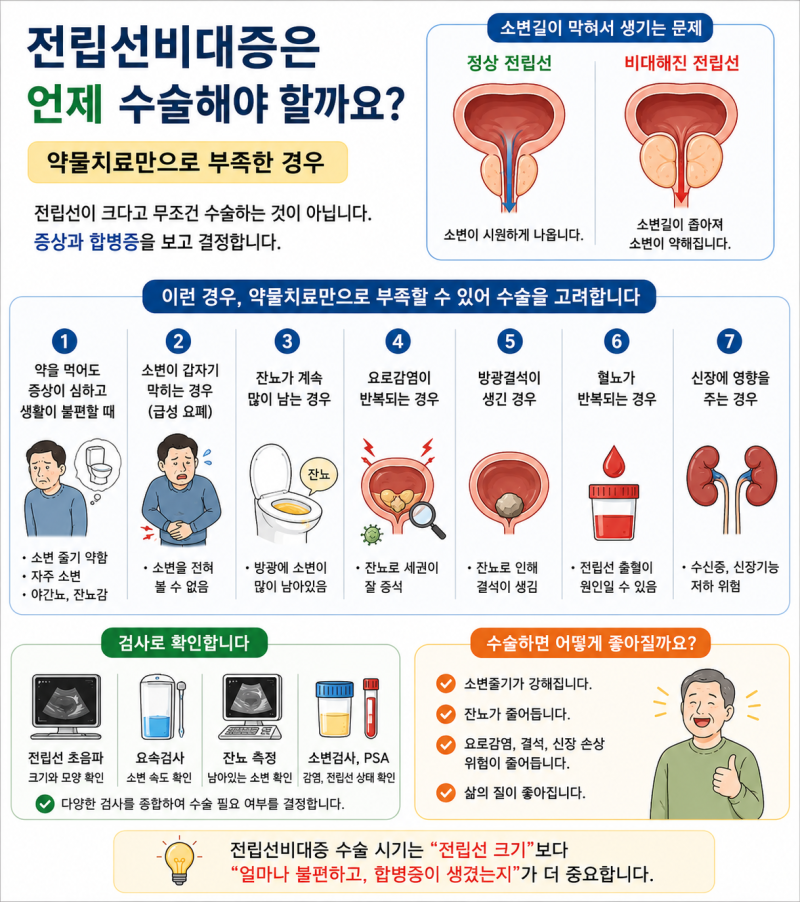 전립선비대증은 언제 수술해야 할까요?｜약물치료만으로 부족한 경우