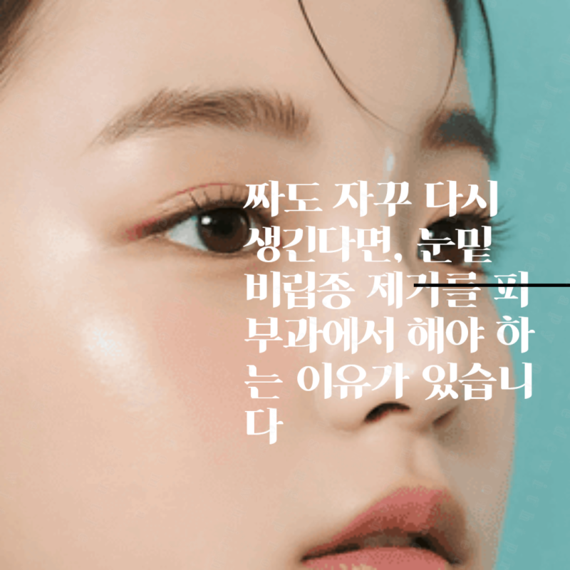 짜도 자꾸 다시 생긴다면, 눈밑 비립종 제거를 피부과에서 해야 하는 이유가 있습니다
