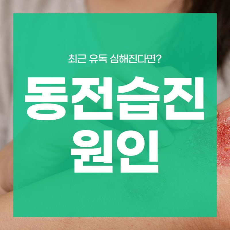 동전습진 원인 최근 유독 심해진다면?