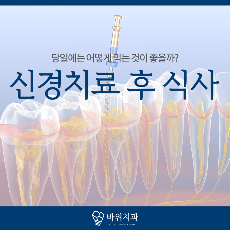 신경치료 후 식사, 당일에는 어떻게 먹는 것이 좋을까?