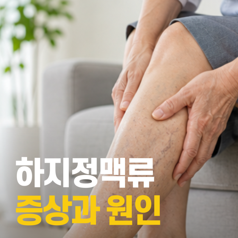 오래 서 있어서 그런 줄 알았는데… 하지정맥류 의심 증상