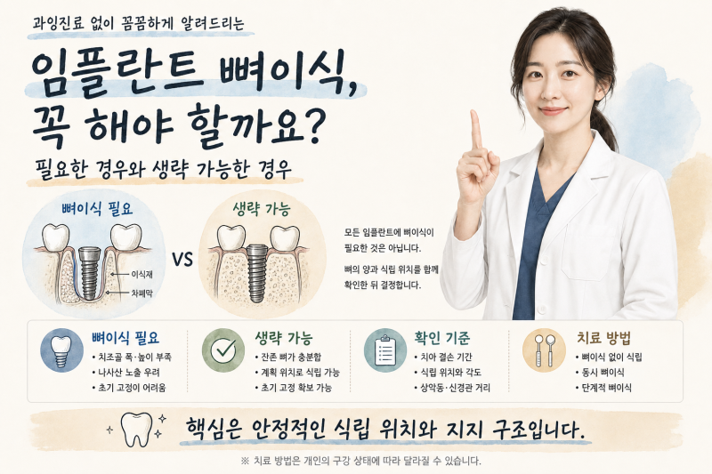 의외로 모르는 "상계역 임플란트 치과추천, 뼈이식은 꼭 해야 할까요?"