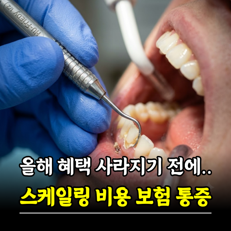 "올해 혜택 사라지기 전에.." 스케일링 비용 보험 주기 통증, 스케일링후 식사