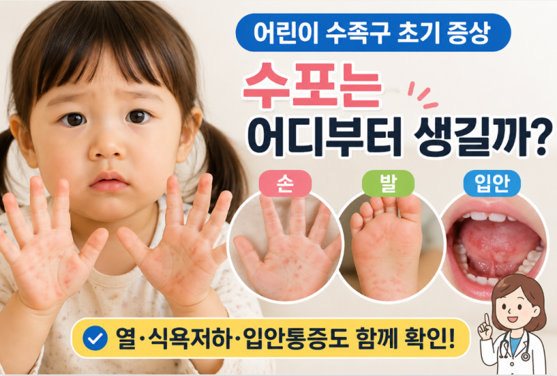 아기 어린이 수족구 초기 증상 , 수포는 어디부터 생길까?