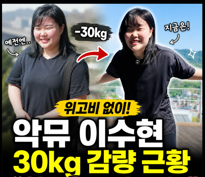 악뮤 이수현, 30kg 감량 후 근황… “위고비 없이 이 정도라고?”