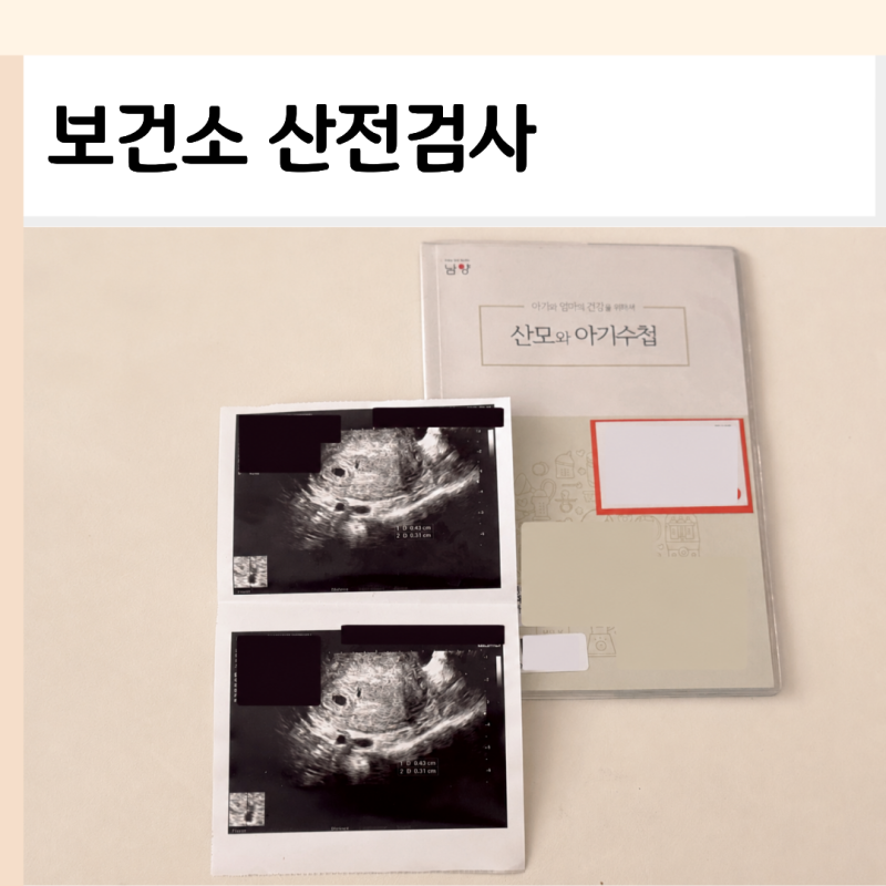 보건소 산전검사 예약 금식 여부 비용 결과 확인까지 경험담