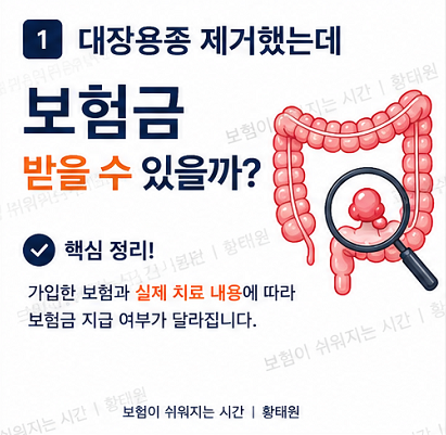 대장용종 제거했는데 보험금 받을 수 있을까?