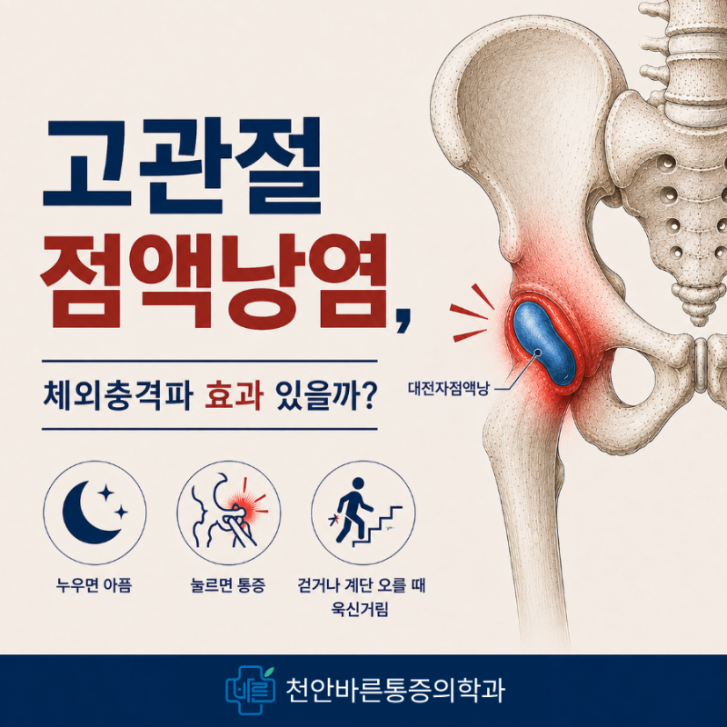 오른쪽 엉덩이 찌릿 통증, 고관절점액낭염이라면 체외충격파 효과 있을까?| 천안 청수동 정....